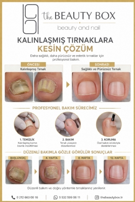Mantarlı Tırnak Bakımı